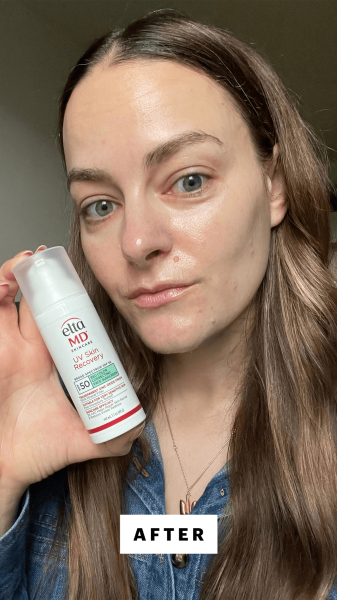 Panych after applying the EltaMD UV Skin Recovery Red Color Correcting Green Tint SPF 50