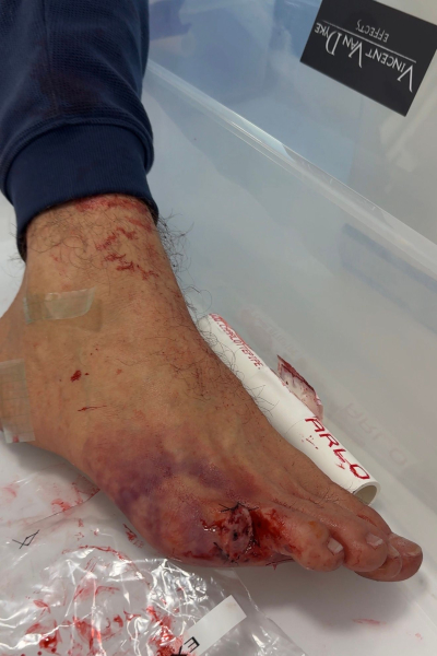 A prosthetic foot with the pinky toe missing from the Euphoria special effect designer